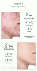 LAJU ACNE TREATMENT SERUM 20Ml - Image 9